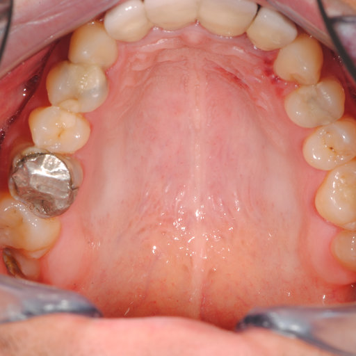 Before image