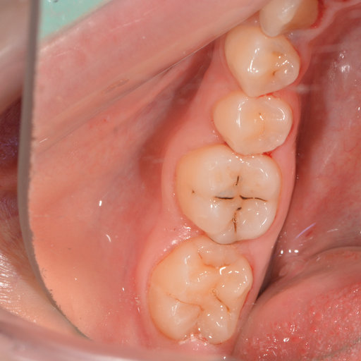 Before image