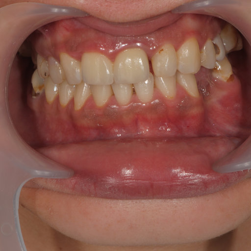 Before image