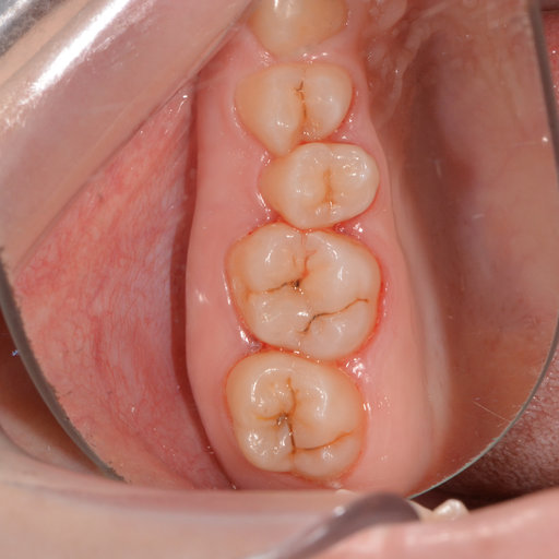 Before image