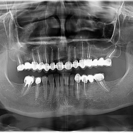 Before image