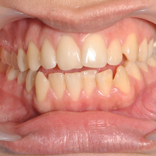Before image