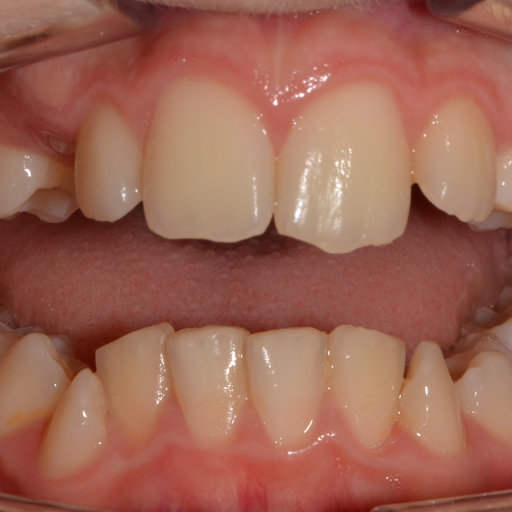 Before image