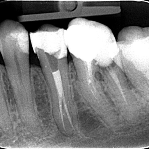 After image
