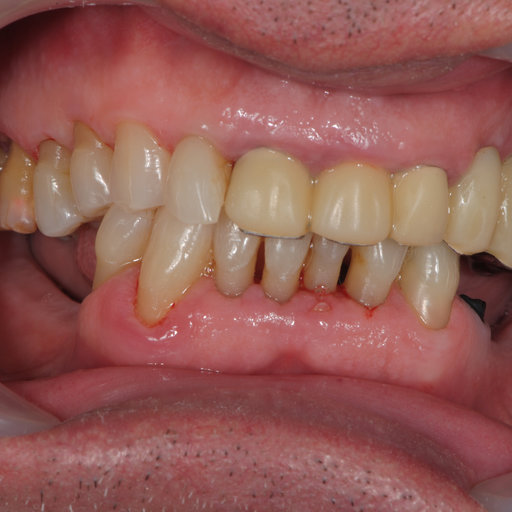Before image