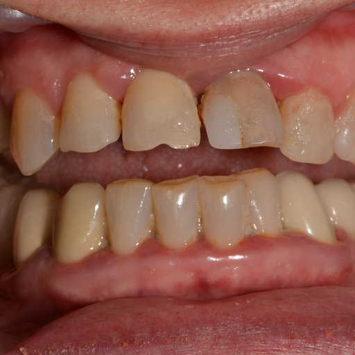 Before image