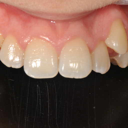 Before image