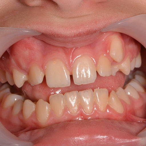 Before image