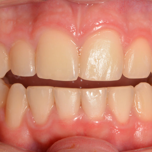 After image