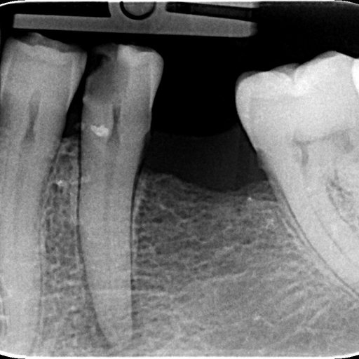 Before image