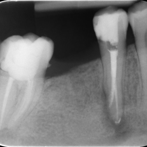 Before image