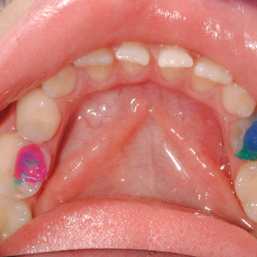 After image