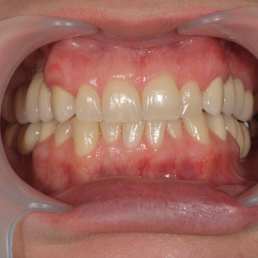Before image