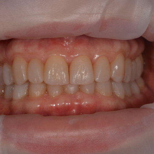After image