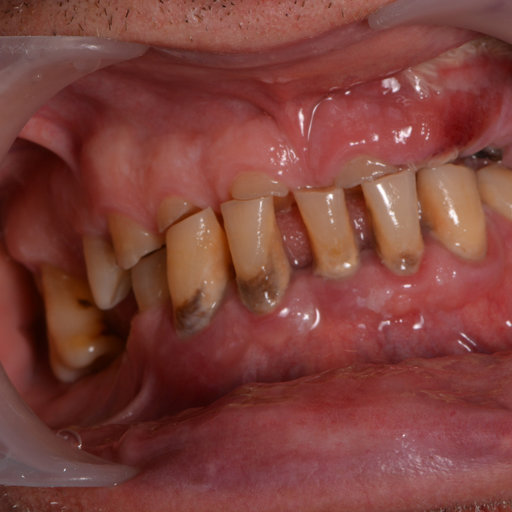 Before image