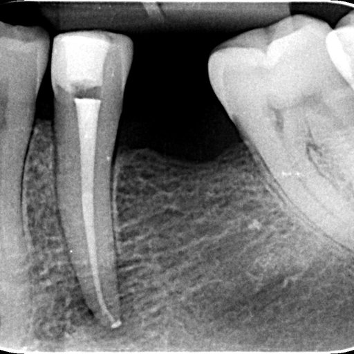 After image