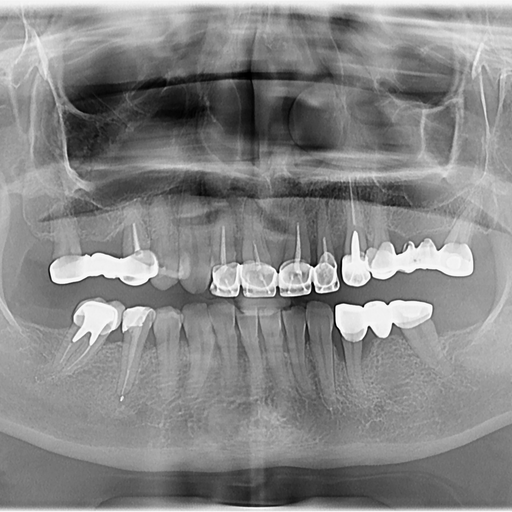 Before image