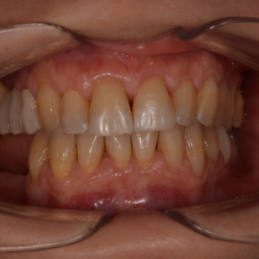Before image