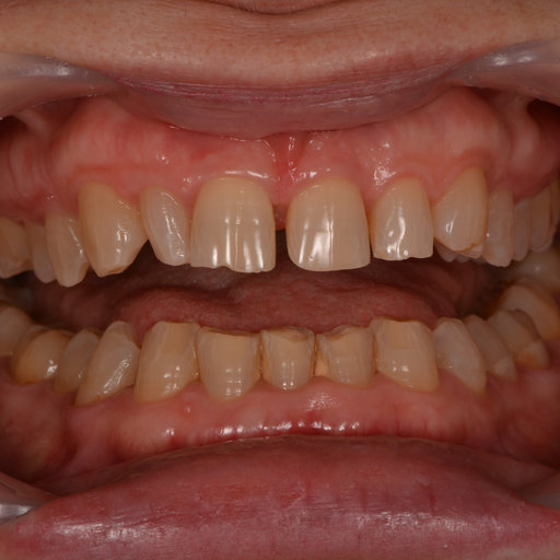 Before image