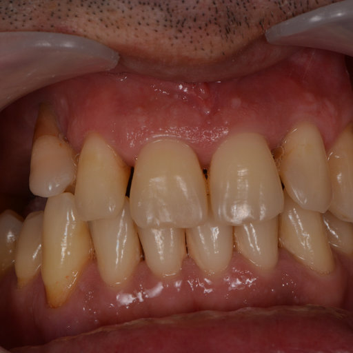 Before image
