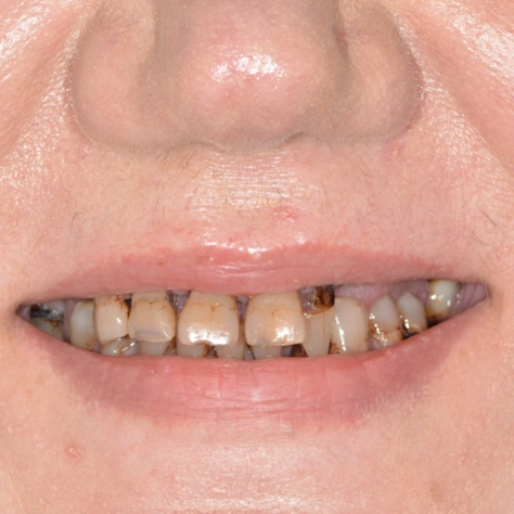 Before image